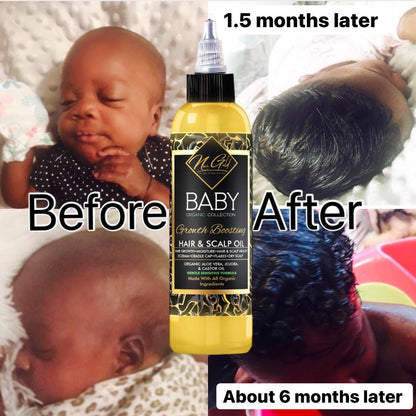 BABY ORGANIC Hair Growth Oil-Growth Boosting Hair Oil(cradle cap, scalp Eczema).