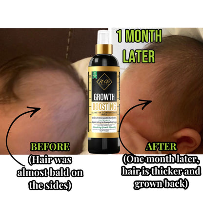 BABY ORGANIC Hair Growth Oil-Growth Boosting Hair Oil(cradle cap, scalp Eczema).